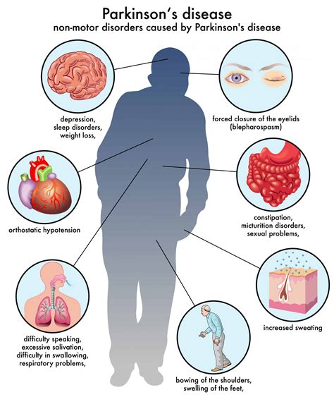 parkinson's disease